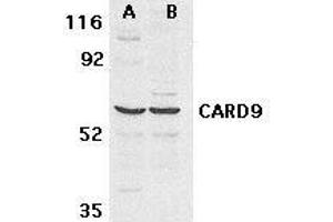 Western blot analysis of CARD9 expression in human MDA- MB-361 (A) and PC-3 (B) cell lysate withCARD9 antibody at 2. (CARD9 Antikörper)