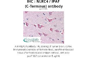 Image no. 1 for anti-NLR Family, CARD Domain Containing 4 (NLRC4) antibody (ABIN1737383) (NLRC4 Antikörper)