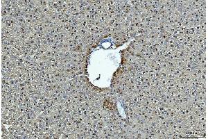 IHC analysis of ADH1A using anti-ADH1A antibody (ABIN4886427).