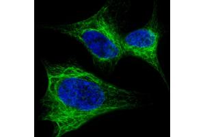 Fluorescent confocal image of SH-SY5Y cells stained with Nestin  antibody. (Nestin Antikörper  (AA 1389-1416))