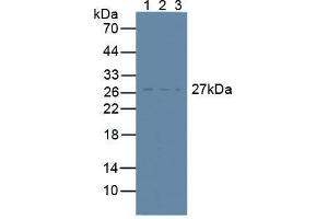 Western blot analysis of (1) Human Lymphocytes Cells, (2) Human U-87MG Cells and (3) Mouse RAW 2647 Cells. (CD81 Antikörper  (AA 113-201))