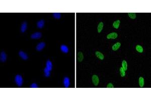 Immunocytochemistry (ICC) image for anti-Chromobox Homolog 1 (CBX1) antibody (ABIN1845962) (CBX1 Antikörper)