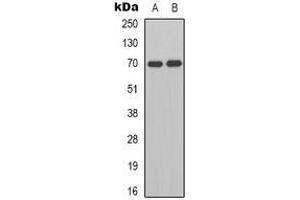 Western blot analysis of HGF activator expression in K562 (A), Jurkat (B) whole cell lysates.