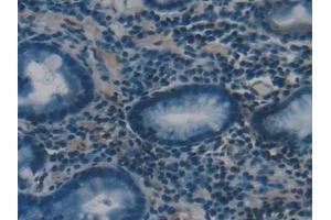 Immunohistochemistry (IHC) image for anti-Proteasome (Prosome, Macropain) 26S Subunit, ATPase, 1 (PSMC1) (AA 1-440) antibody (ABIN7442210)