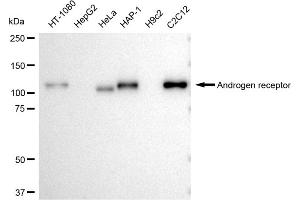 Western blotting analysis using Androgen receptor antibody (ABIN7797599).
