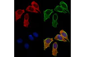 ABIN6258673 and ABIN6275145 staining HepG2 cells by IF/ICC.