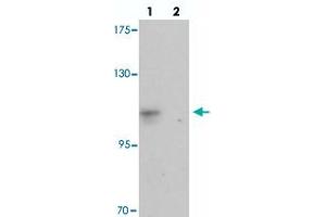 Western blot analysis of CASKIN2 in HeLa cell lysate with CASKIN2 polyclonal antibody  at 1 ug/mL in (lane 1) the absence and (lane 2) the presence of blocking peptide. (CASKIN2 Antikörper  (N-Term))