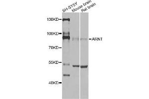Western blot analysis of extracts of various cell lines, using ARNT Antibody (ABIN5970360) at 1/1000 dilution. (ARNT Antikörper)