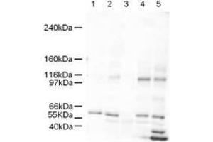 Western blot using  Affinity Purified anti-SmarcAL1 antibody shows detection of a band ~106 kDa band (arrowhead) corresponding to SmarcAL1 in human derived cultured cell lysates (HeLa nuclear extract lane 1, HeLa lane 2, A431 lane 3, Jurkat lane 4, and 293 lane 5). (SMARCAL1 Antikörper  (AA 75-100))