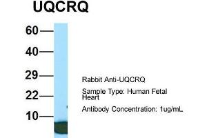 Host: Rabbit  Target Name: UQCRQ  Sample Tissue: Human Fetal Heart  Antibody Dilution: 1.