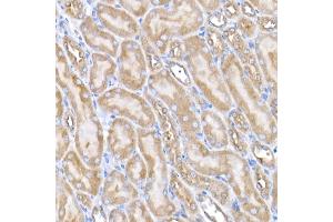 Immunohistochemistry of paraffin-embedded mouse kidney using USO1 Rabbit mAb (ABIN7271234) at dilution of 1:25 (40x lens). (USO1 Antikörper)