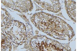 ABIN6269276 at 1/100 staining Mouse testis tissue by IHC-P.