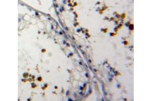 Used in DAB staining on fromalin fixed paraffin-embedded testis tissue (NUP62 Antikörper  (AA 186-432))