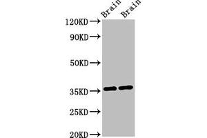 Western Blot Positive WB detected in: Mouse brain tissue, Rat brain tissue All lanes: NIT1 antibody at 3 μg/mL Secondary Goat polyclonal to rabbit IgG at 1/50000 dilution Predicted band size: 36, 32, 41, 35, 27 kDa Observed band size: 36 kDa (Nitrilase 1 Antikörper  (AA 1-243))