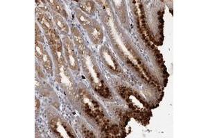 Immunohistochemical staining of human stomach with SLC41A2 polyclonal antibody  shows strong cytoplasmic positivity in glandular cells at 1:50-1:200 dilution. (SLC41A2 Antikörper)