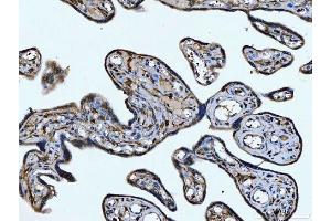 IHC analysis of CD14 using anti-CD14 antibody (ABIN7600531). (CD14 Antikörper  (AA 20-259))