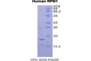 SDS-PAGE analysis of Human Ribophorin I Protein. (RPN1 Protein)