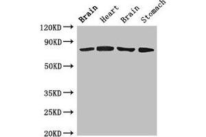 Western Blot Positive WB detected in: Rat brain tissue, Rat heart tissue, Mouse brain tissue, Mouse stomach tissue All lanes: SLCO1B1 antibody at 4 μg/mL Secondary Goat polyclonal to rabbit IgG at 1/50000 dilution Predicted band size: 77 kDa Observed band size: 77 kDa (SLCO1B1 Antikörper  (AA 426-537))