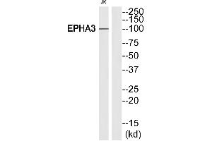 Western blot analysis of extracts from Jurkat cells, using EPHA3 (Ab-602)antibody. (EPH Receptor A3 Antikörper  (Internal Region))