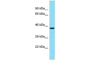 Host: Rabbit Target Name: C14orf79 Sample Type: HepG2 Whole Cell lysates Antibody Dilution: 1. (C14ORF79 Antikörper  (N-Term))