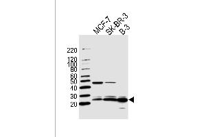 Western blot analysis of lysates from MCF-7, SK-BR-3, B-3 cell line (from left to right), using C13orf30 Antibody (C-term) (ABIN1944729 and ABIN2838567). (C13orf30 Antikörper  (C-Term))