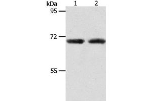 Western Blot analysis of Human liver cancer and fetal kidney tissue using ACOT11 Polyclonal Antibody at dilution of 1:650 (ACOT11 Antikörper)