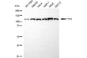 Western blotting analysis using TTF2 antibody (ABIN7800596).