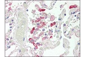 Image no. 1 for anti-Carboxylesterase 1 (CES1) (Internal Region) antibody (ABIN372769) (CES1 Antikörper  (Internal Region))