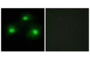 Immunofluorescence analysis of HeLa cells, using TPD52 antibody.
