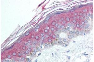 Human Skin (formalin-fixed, paraffin-embedded) stained with HDAC4 antibody ABIN292441 at 1:50 followed by biotinylated goat anti-rabbit IgG secondary antibody ABIN481713, alkaline phosphatase-streptavidin and chromogen. (HDAC4 Antikörper  (N-Term))