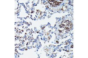 Immunohistochemistry (IHC) image for anti-Apolipoprotein B mRNA Editing Enzyme, Catalytic Polypeptide-Like 3G (APOBEC3G) (AA 60-330) antibody (ABIN6137010)