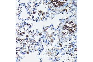 Immunohistochemistry of paraffin-embedded rat lung using G Rabbit pAb (ABIN6129931, ABIN6137010, ABIN6137011 and ABIN6217659) at dilution of 1:100 (40x lens). (APOBEC3G Antikörper  (AA 60-330))