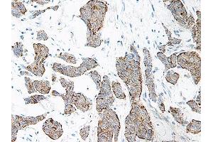 Image no. 3 for anti-Interleukin 17A (IL17A) antibody (ABIN465126)