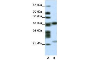 PHF11 antibody used at 0. (PHF11 Antikörper  (Middle Region))