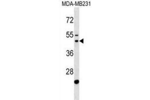 Western Blotting (WB) image for anti-GATS Protein-Like 1 (GATSL1) antibody (ABIN3000715) (GATSL1 Antikörper)