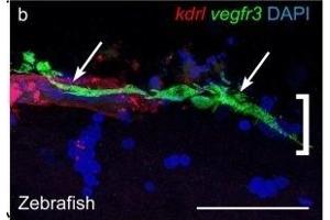 Cells with BLEC molecular markers are present within the mouse leptomeninges. (RFP Antikörper)