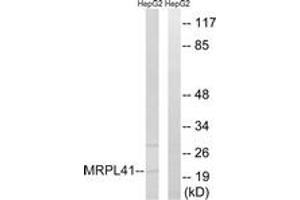 Western blot analysis of extracts from HepG2 cells, using MRPL41 Antibody.