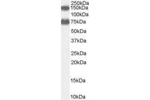 Western Blotting (WB) image for Acyl-CoA Oxidase 2, Branched Chain (Acox2) peptide (ABIN369198) (Acyl-CoA Oxidase 2, Branched Chain (Acox2) Peptid)