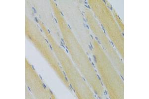 Immunohistochemistry of paraffin-embedded mouse skeletal muscle using CXCR3 Antibody (ABIN5971514) at dilution of 1/100 (40x lens).