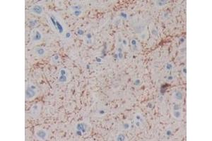 Used in DAB staining on fromalin fixed paraffin- embedded Kidney tissue (MAG Antikörper  (AA 328-514))