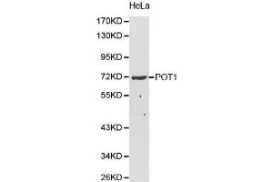 Western Blotting (WB) image for anti-Protection of Telomeres 1 (POT1) (AA 497-634) antibody (ABIN5663924) (POT1 Antikörper  (AA 497-634))