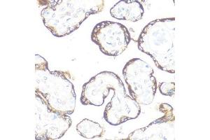 Immunohistochemistry of paraffin-embedded human placenta using FGFR2 antibody. (FGFR2 Antikörper  (AA 1-100))