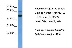 WB Suggested Anti-IQCB1  Antibody Titration: 0. (IQCB1 Antikörper  (C-Term))