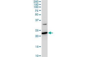 SEC22B monoclonal antibody (M03), clone 5A10. (SEC22B Antikörper  (AA 1-110))