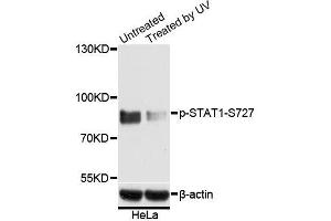Western blot analysis of extracts of various cell lines,using Phospho-STAT1-S727 antibody.