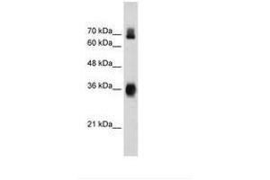 Image no. 2 for anti-Kelch-Like ECH-Associated Protein 1 (KEAP1) (AA 543-592) antibody (ABIN203292) (KEAP1 Antikörper  (AA 543-592))