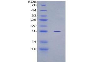 SDS-PAGE (SDS) image for Glyceraldehyde-3-Phosphate Dehydrogenase (GAPDH) ELISA Kit (ABIN6574294)