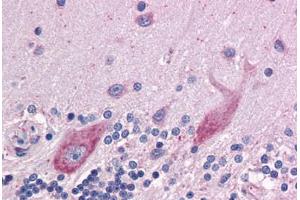 Human Brain, cerebellum: Formalin-Fixed, Paraffin-Embedded (FFPE) (DPF2 Antikörper  (AA 56-155))