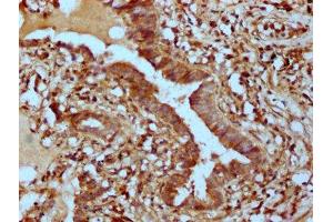 Immunohistochemistry (IHC) image for anti-Phosphatase and Actin Regulator 1 (PHACTR1) (AA 263-387) antibody (ABIN7163100)