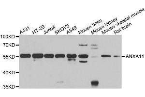 Western blot analysis of extracts of various cell lines, using ANXA11 antibody. (Annexin A11 Antikörper  (AA 276-505))